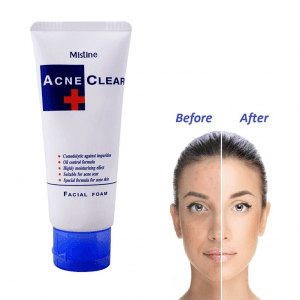 Mistine Acne Clear Facial Foam