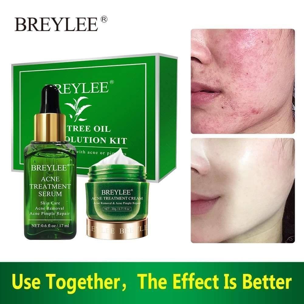 Breylee Acne Treatment Serum