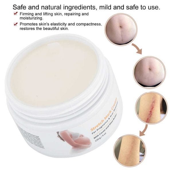 Melao Stretch Mark Cream