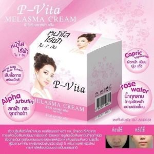 P Vita Melasma Cream