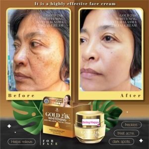 Gold 24K Whitening Anti Melasma Facial Cream