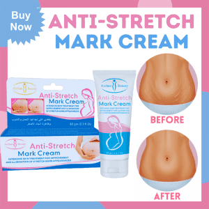 Aichun Beauty Anti Stretch Mark Cream