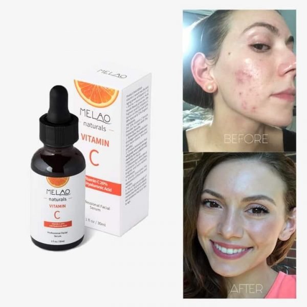 Melao Naturals Vitamin C Serum